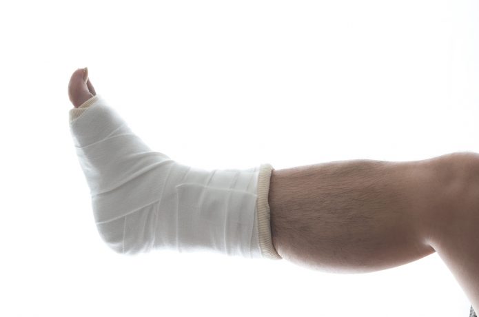 ランニングでアキレス腱が断裂した時の対処法