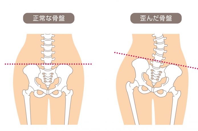 快適なランニングの鍵 骨盤 を意識して走ろう Run Hack ランハック