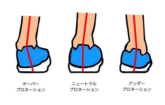 プロネーションの3種類