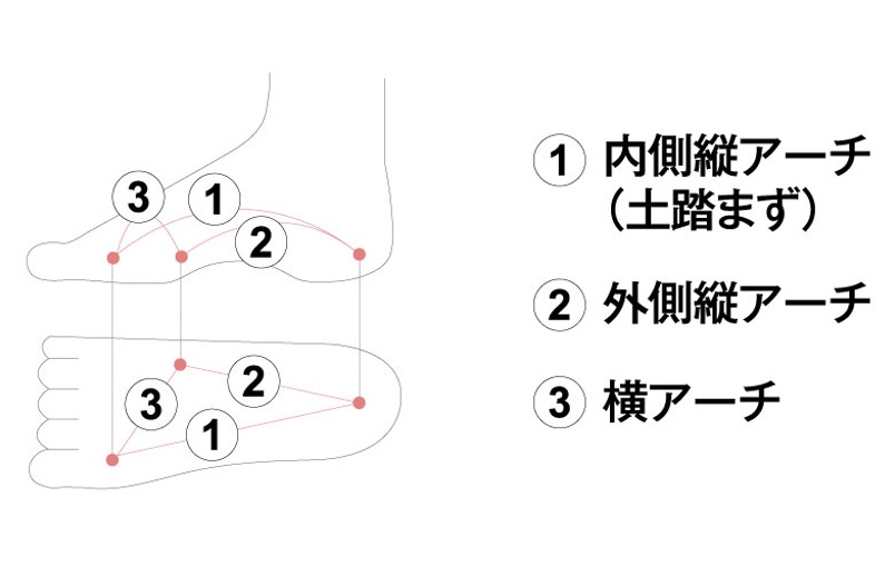 足のアーチの種類